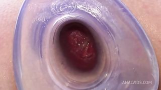 Queen Eugenia and her huge anal gape... outdoor