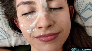 18YO FACIAL CUM TREATMENT WORSHIP