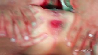 first anal 0% pussy for teen EMILY WHITE 2 on 1. LTP108