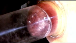 BREAST INFLATION/EXPANSION