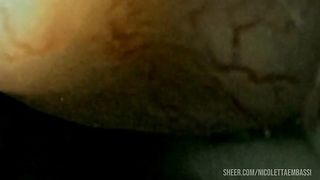 Looped anal trip in hemorrhoid filled asshole - Vore endoscopy video with heartbeat