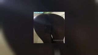 Anal Exposure Montage