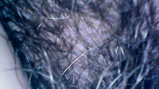 Hairy exploration peeing with endoscope on the toilet