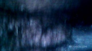 Hairy exploration peeing with endoscope on the toilet