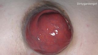 DIRTYGARDENGIRL - MORE ANAL SPREADER