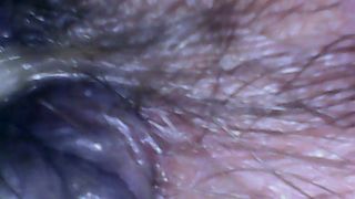 Hairy ass exploration with endoscope and farts 4K
