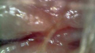 Loud microscope farts inside my asshole 1080HD