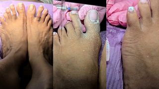 DRY PEDICURE AFTER 3 MONTHS OF GROWTH!!!