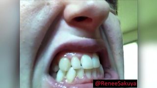 UPCLOSE INSIDE LOOK OF HER MOUTH AND TEETH, FETISH VIDEO
