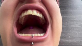 TEETH CHECK-UP ON THE BUS