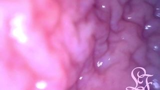 INSIDE POV: INFLATING MY BLADDER WITH AIR!