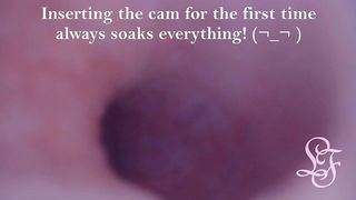 FISRT EVER POV COMSHOT FROM INSIDE THE PROSTATE