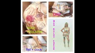 KYRA SEX & PRISCILA BELINI FIST LAB / 4 ON 1 AND GIRL / ANAL FISTING + 2 HANDS + COCK / RIMING TO MAN / DP / DAP / DIRTY TALK / HUGE PROLAPSE / ASS CREAMPIE