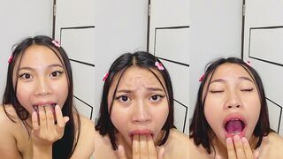 MOUTH GAGGING