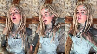 IN THIS LONG VIDEO I WILL EXPLAIN WHY I DO MY MELON AND MY UPPER BLEPHAROPLASTY SURGERY AND WHAT I NEED TO TAKE CARE OF BEFORE. ENJOY