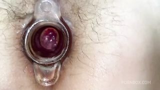 WE STRETCH AND WIDEN A MATURE WOMAN'S HAIRY ANAL. VERY DIRTY ANAL OF A HOT BITCH SHE MOANS, HER ANAL SECRET IS LUBRICATED.